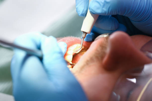 Best Knocked-Out Tooth Emergency  in Parkland, FL