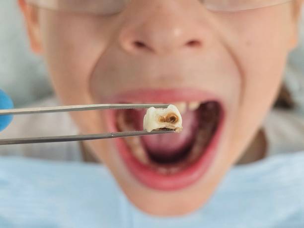 Best Dentist for Dental Trauma  in Parkland, FL