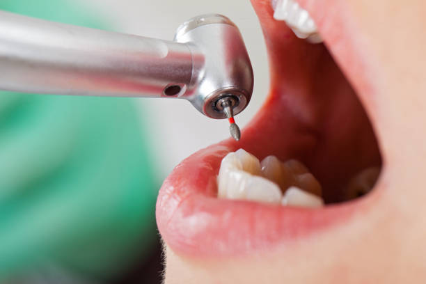 Best Urgent Tooth Repair  in Parkland, FL